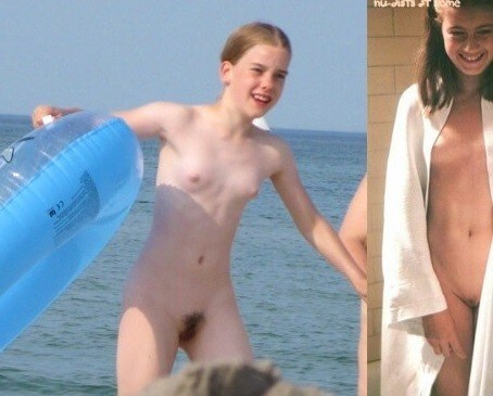 Bare Lake Days photos - The community of naturist movement supporters